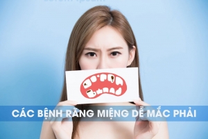 Báo động đỏ về tình trạng răng miệng tại Việt Nam
